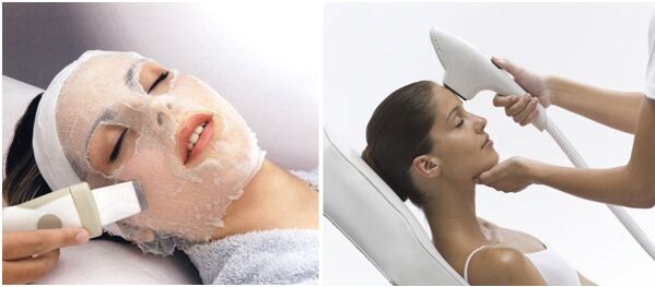 limpieza facial